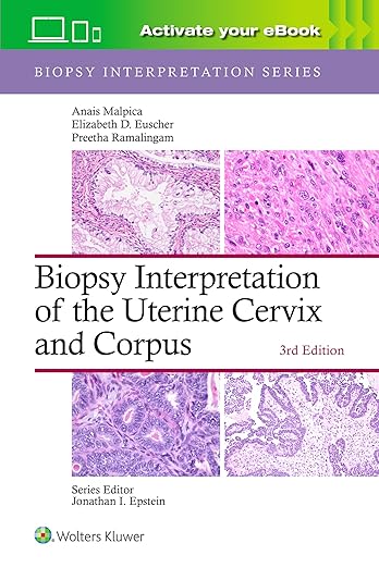 Biopsy Interpretation of the Uterine Cervix and Corpus: Print + eBook with Multimedia
