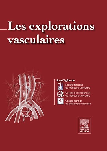 Explorations Vasculaires