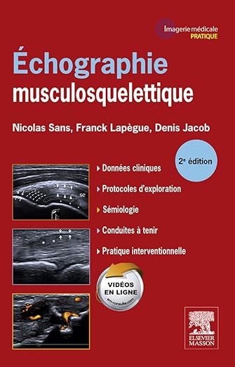 Echographie Musculosquelettique