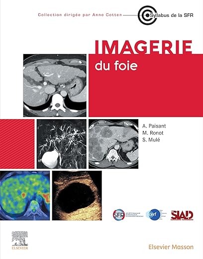 Imagerie du Foie