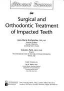 Clinical Success in Surgical and Orthodontic Treatment of Impacted Teeth