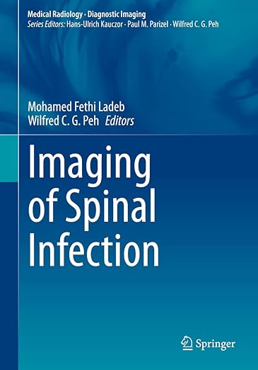Imaging of Spinal Infection