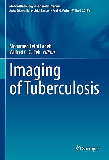 Imaging of Tuberculosis