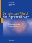 Dermatoscopic Atlas of Non-Pigmented Lesions