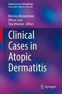 Clinical Cases in Atopic Dermatitis