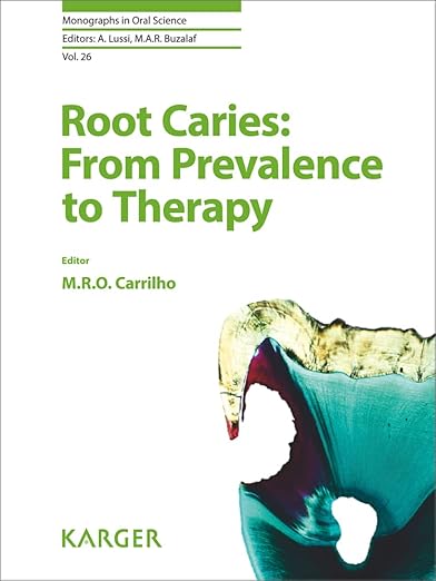 Root Caries