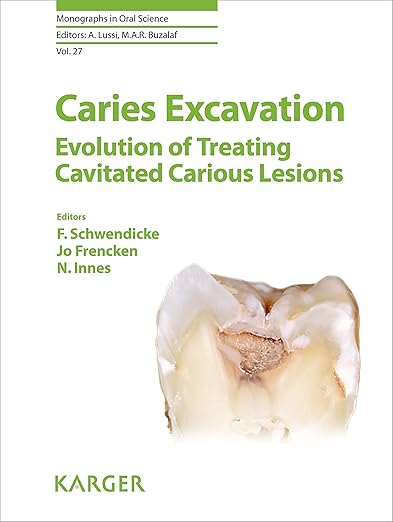 Caries Excavation