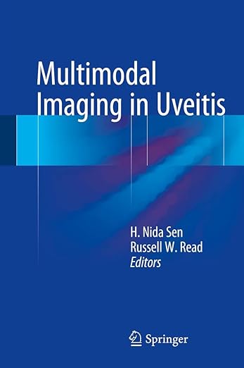 Multimodal Imaging in Uveitis