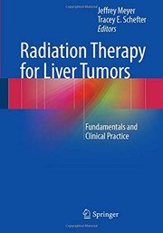 Radiation Therapy for Liver Tumors