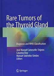 Rare Tumors of the Thyroid Gland