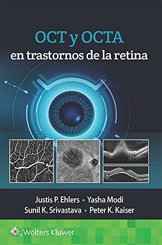 OCT y OCTA