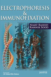Electrophoresis and Immunofixation