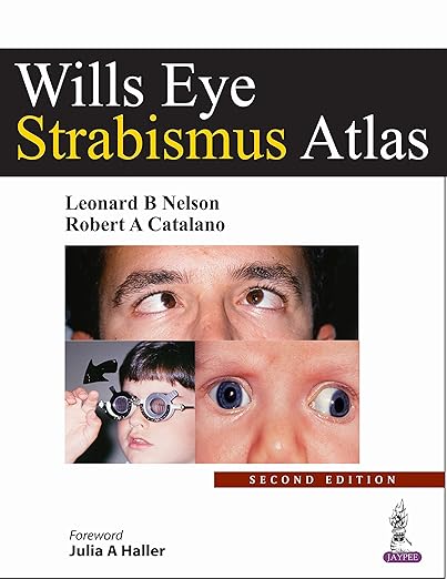Wills eye strabismus atlas