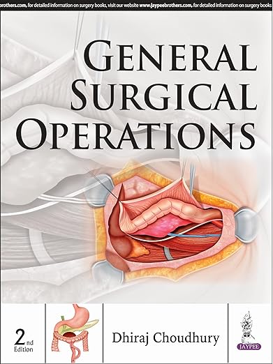 General Surgical Operations