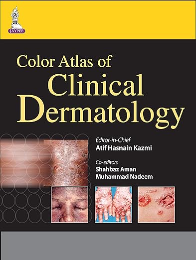 Color Atlas of Clinical Dermatology