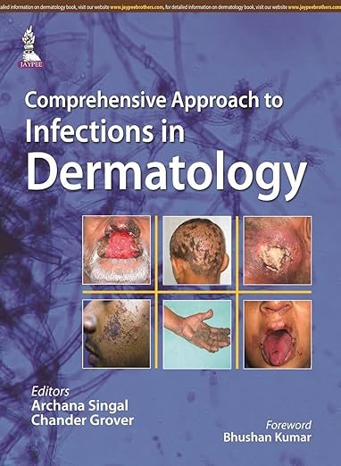 Comprehensive Approach to Infections in Dermatology