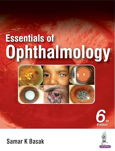 Essentials of Ophthalmology