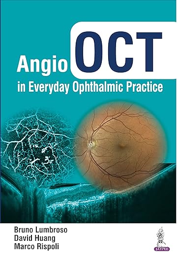Angio OCT in Everyday Ophthalmic Practice