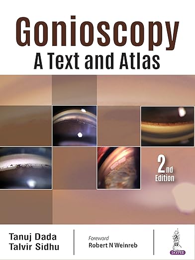 Gonioscopy
