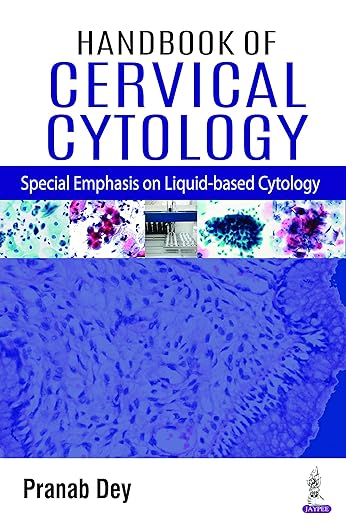 Handbook of Cervical Cytology