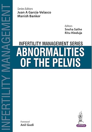 Abnormalities of the Pelvis