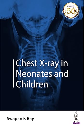 Chest X-Ray in Neonates and Children