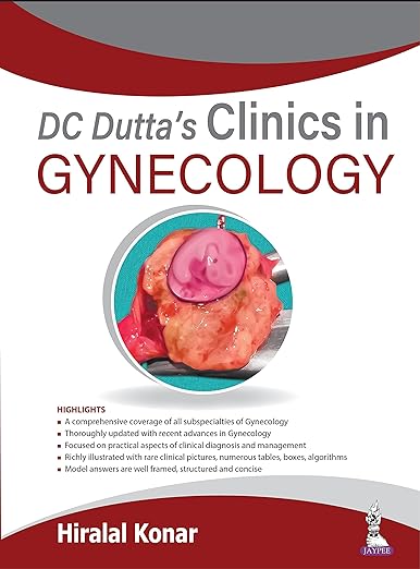 DC Dutta's Clinics in Gynecology