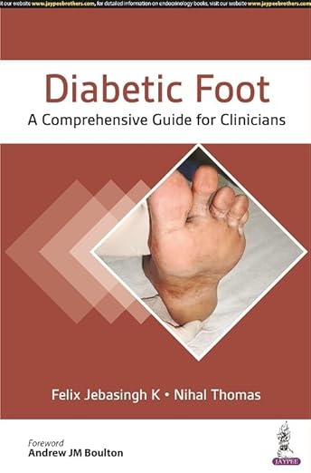 Diabetic Foot : Comprehensive Guide Cli