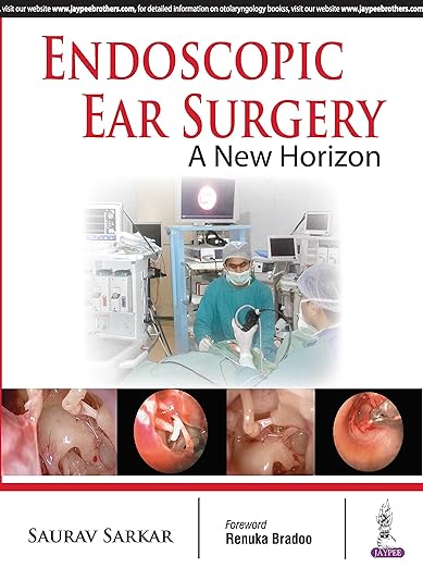 Endoscopic Ear Surgery a New Horizon