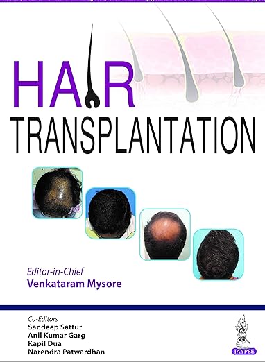 Hair Transplantation