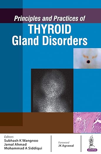 Principles and Practices of Thyroid