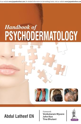 Handbook of Psychodermatology