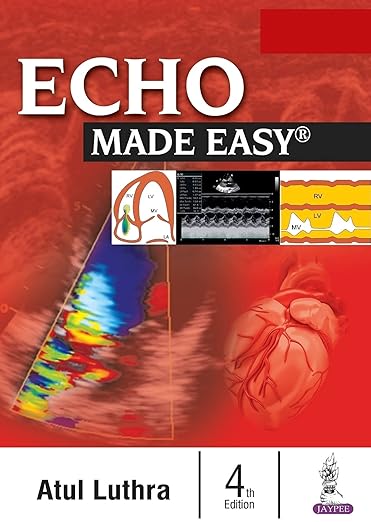 Echo Made Easy