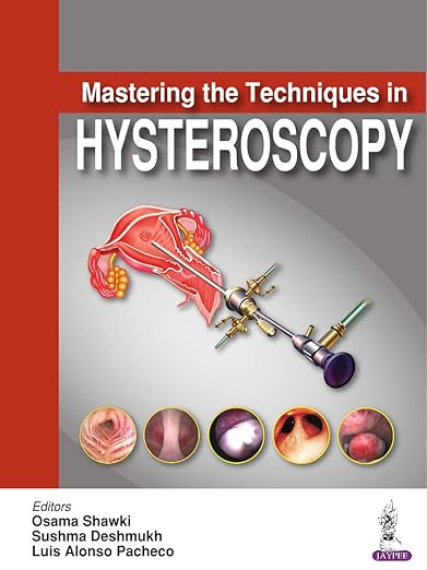 Mastering the Techniques in Hysteroscopy
