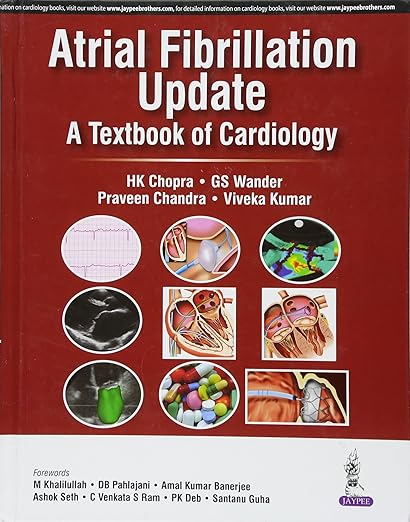 Atrial Fibrillation Update