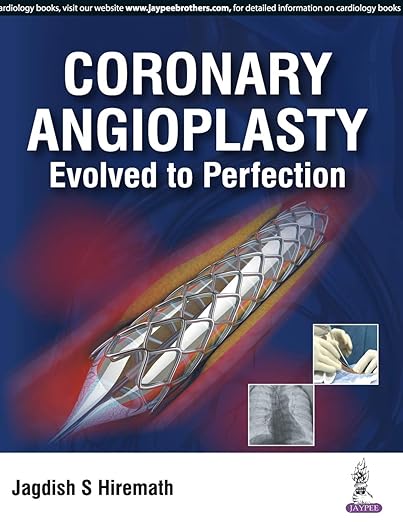 Coronary Angioplasty Evolved Perfection