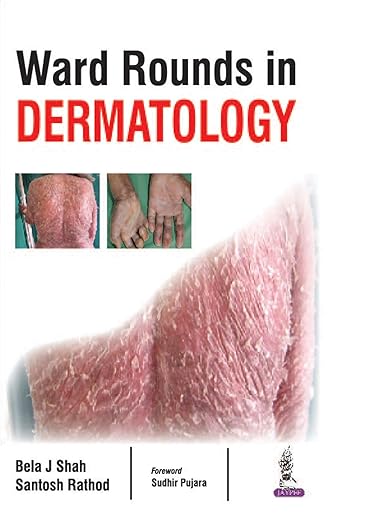 Ward Rounds in Dermatology