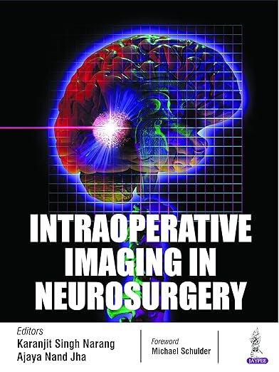 Intraoperative Imaging in Neurosurgery