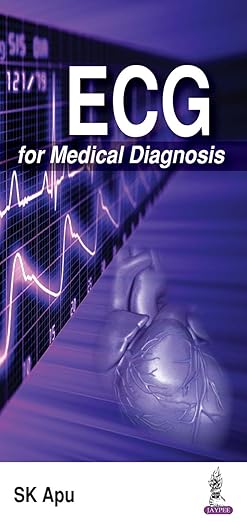 ECG for Medical Diagnosis