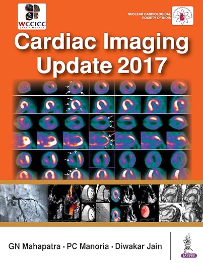 Cardiac Imaging Update 2017