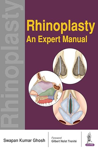 Rhinoplasty