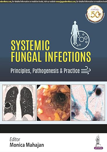 Systemic Fungal Infections