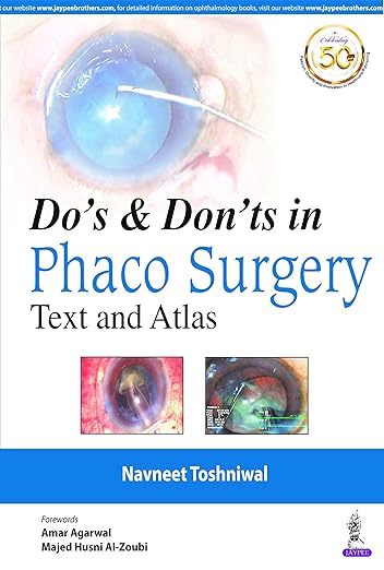 Text Atlas Do's Don'ts Phaco Surgery