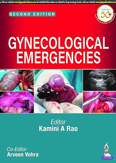 Gynecological Emergencies