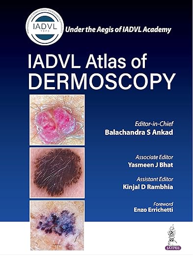 Atlas of Dermoscopy