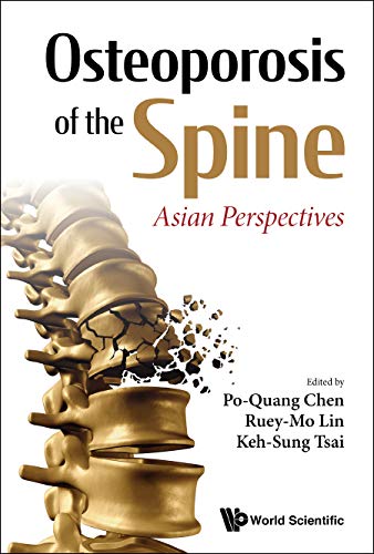 Osteoporosis of Spine Asian Perspectivhb : Osteoporosis of the Spine