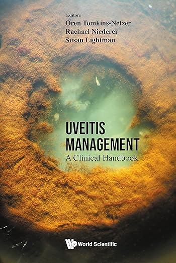 Uveitis Management