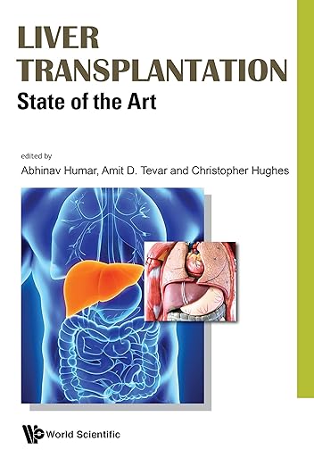 Liver Transplantation