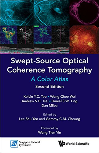 Swept-Source Optical Coherence Tomography