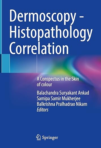 Dermoscopy - Histopathology Correlation